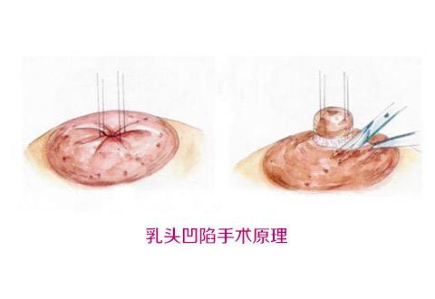 沈陽百嘉麗醫(yī)院之汪曉蕾：她的醫(yī)療造詣如何？