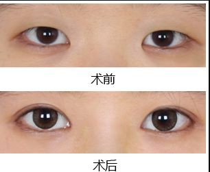 鄭州去黑點(diǎn)哪家醫(yī)院好？揭秘最受歡迎的黑點(diǎn)去除醫(yī)院