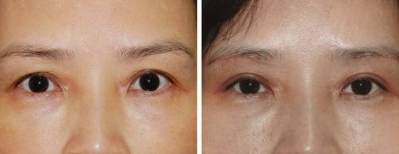 上海激光美容醫(yī)院排名及熱門選擇，哪家好？