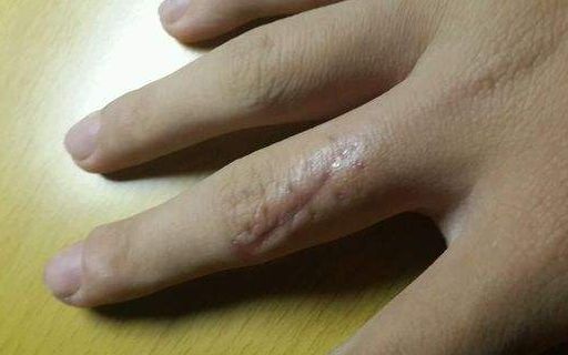 上海哪家醫(yī)院做肋骨鼻子整形手術(shù)好？
