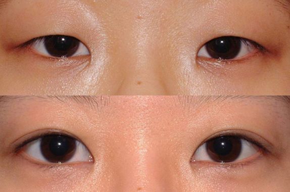 蘇州打瘦臉針哪家醫(yī)院好？2023年蘇州瘦臉針治療排行榜發(fā)布