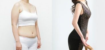 成都做雙眼皮，哪家醫(yī)院專業(yè)可靠？