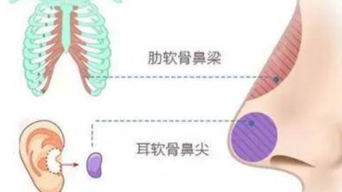 廣州有哪些醫(yī)院可以進(jìn)行抽脂手術(shù)？