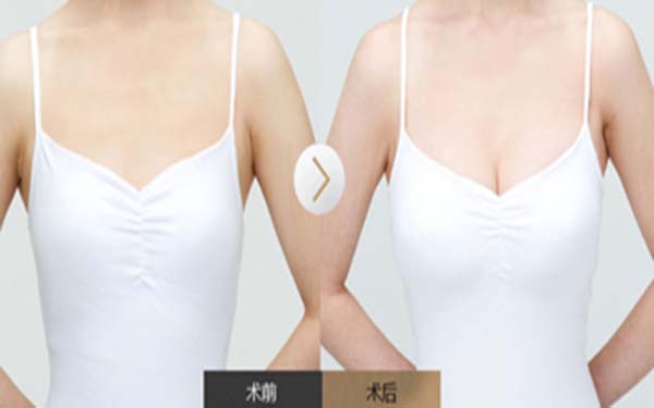 2023廈門(mén)射頻點(diǎn)陣祛雀斑醫(yī)生口碑TOP10(劉歆、李東偉、鄒燕林值得了解！)