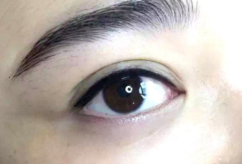 武漢唇腭裂手術(shù)專家推薦！精選專家名單，1期2期修復(fù)全搜羅！