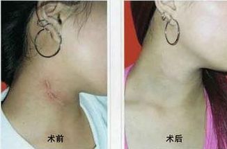 南寧哪家醫(yī)院治痘效果好？選擇明星們的美肌秘密推薦的南寧優(yōu)質(zhì)醫(yī)院