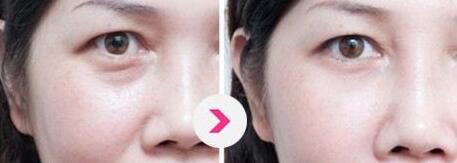 上海知名眼部整形專家出爐！2023年度指定眼王整形專家名單公布，附價格表參考！