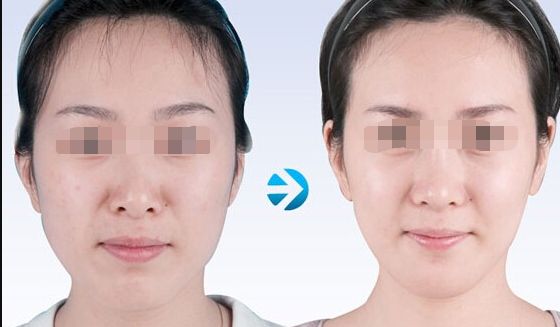 蘇州哪家吸脂好又實(shí)惠？專業(yè)美容機(jī)構(gòu)為您推薦