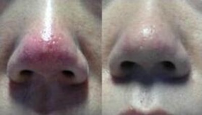 福州哪家醫(yī)生做隆胸技術(shù)好？推薦五位專業(yè)醫(yī)師，價(jià)格參考！