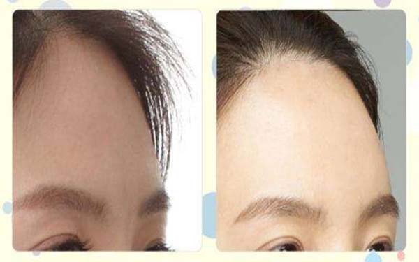 全國整容醫(yī)生PHD公開名單，創(chuàng)新技術(shù)行業(yè)新標(biāo)桿