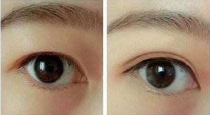 合肥哪家整形醫(yī)院好口碑好服務(wù)好值得推薦？
