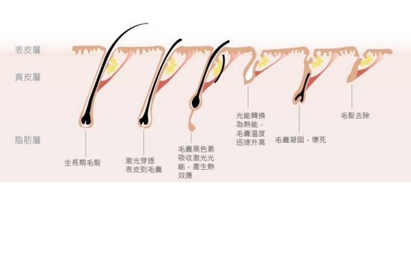 深圳哪家激光祛斑醫(yī)院口碑好？