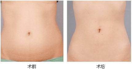 2023湘潭彩光美白嫩膚專家前10位排行榜(劉佑文、熊宜文、熊志能幫你圓夢(mèng))