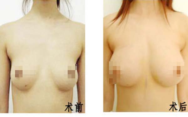 北京景區(qū)楊斌突嘴手術(shù)矯正效果如何？從個(gè)人實(shí)力和大眾評(píng)價(jià)來分析