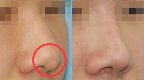 福州哪家醫(yī)院做疤痕好？比較全面的福州疤痕治療醫(yī)院推薦給您！