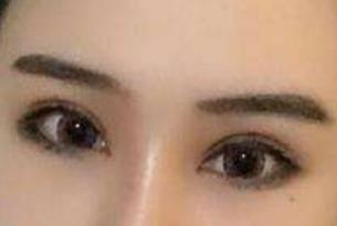 貴陽梁安裕醫(yī)生技術(shù)在線解析腹壁成型效果，怎么樣？