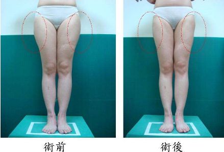 昆明哪家治痘痘好的醫(yī)院，痘痘問題如何有效解決？