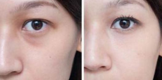 武漢看胎記醫(yī)院哪家好？綜合醫(yī)療機構(gòu)排行榜詳細解讀