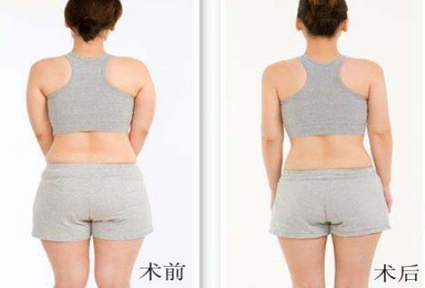 洛陽雙眼皮好的醫(yī)院有哪些？