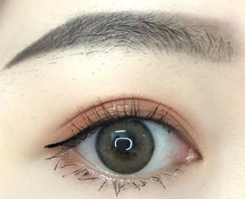 成都哪家美容醫(yī)院的埋線減肥效果好？