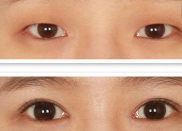 鄭州哪家美容醫(yī)院正規(guī)且口碑好？