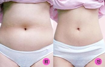 【2023吉林雙眼皮手術(shù)評測】哪家醫(yī)院值得信賴？