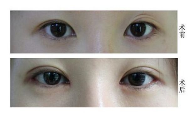 天津修復唇腭裂的醫(yī)院哪家好？專業(yè)解讀！