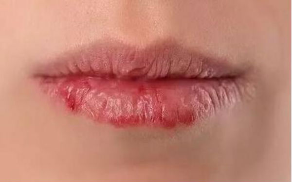 2023石家莊做眼袋手術(shù)評(píng)分十強(qiáng)醫(yī)生(王晶晶、種冬至、宋倩都是行業(yè)內(nèi)的佼佼者！)