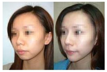 秦皇島美容美體哪家好？刷爆朋友圈的秘密美容院大揭秘！