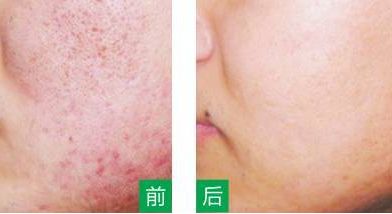 永州美辰醫(yī)療整形醫(yī)院的價格如何？收費標(biāo)準(zhǔn)透明公開，術(shù)前注意事項必看！
