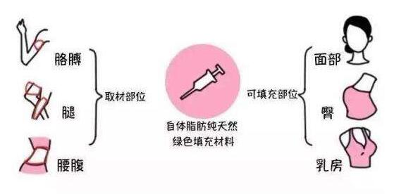 成都潘紅偉吸脂手術(shù)效果如何？專家解讀！