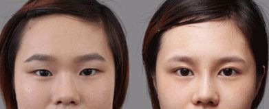 合肥哪家處女膜修復(fù)醫(yī)院靠譜又專業(yè)？