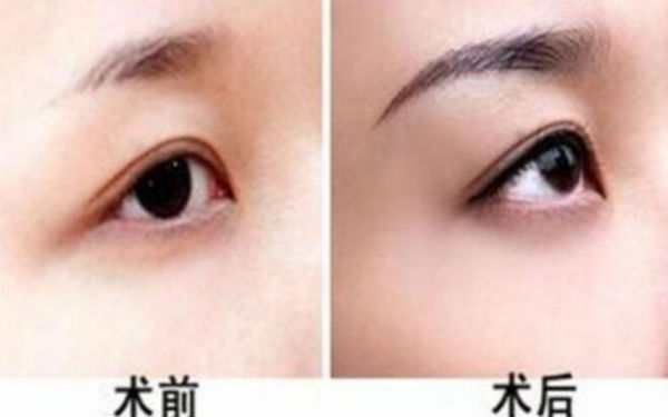 西京醫(yī)院超贊整形醫(yī)生與驚人隆鼻案例，受歡迎至極！