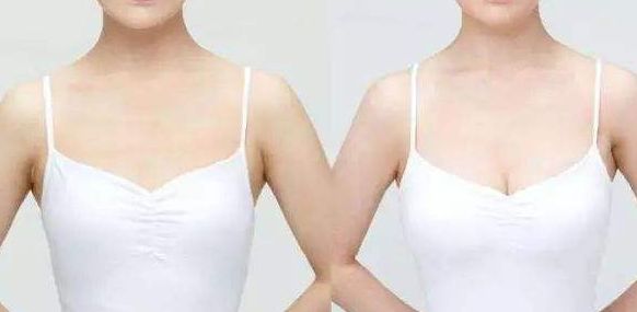 威海假體豐胸醫(yī)院哪家好？從專家口碑、手術(shù)效果看威海頂級醫(yī)院推薦！