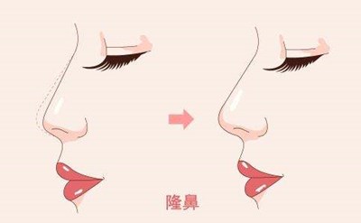 2023西安口周紋注射填充評分10強醫(yī)生(李朋娟、張筠莉、唐龍多院同臺競技爭高下)