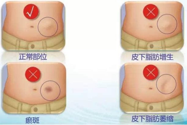 哈爾濱整形醫(yī)院哪家好？選擇哈爾濱整容醫(yī)院前必知的五大關(guān)鍵點