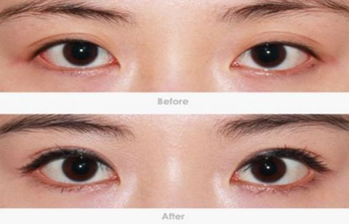 柳州哪家醫(yī)院做疤痕切除好？-獨家分享柳州疤痕切除醫(yī)院排行榜