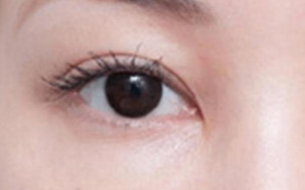 廣州哪家醫(yī)院做隆胸手術(shù)技術(shù)高？醫(yī)生資深經(jīng)驗(yàn)來(lái)看詳細(xì)介紹！