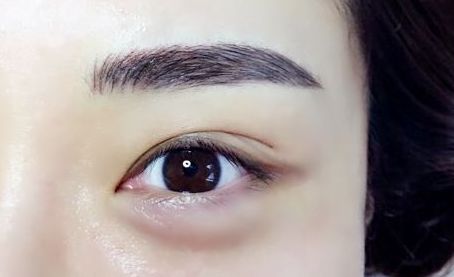 銀川有哪些專業(yè)的激光祛痘印醫(yī)院值得推薦？