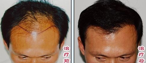 榆林醫(yī)專附屬醫(yī)院醫(yī)學(xué)整形美容中心怎么樣？榆林醫(yī)專附屬醫(yī)院醫(yī)學(xué)整形美容中心簡(jiǎn)介|醫(yī)生團(tuán)隊(duì)|口碑評(píng)價(jià)！