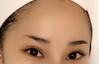 合肥哪家醫(yī)院臉部激光治療效果好，值得推薦？