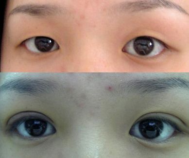 濟(jì)南哪家整形醫(yī)院的拉皮效果好且價(jià)格合適？
