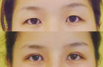 大慶微整形醫(yī)院哪家好？頂級(jí)專(zhuān)家為您解讀微整形醫(yī)院選擇指南！