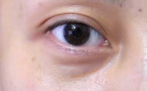 邯鄲哪家醫(yī)院做私密整形好？解析當(dāng)代女性美容訴求