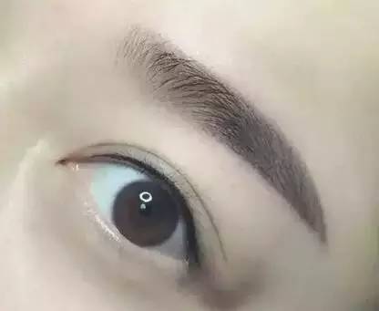 佰華利董萍的面部脂肪填充經(jīng)驗(yàn)，展現(xiàn)自然少女感