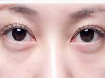 寧波祛斑哪家醫(yī)院好？精選寧波祛斑專業(yè)醫(yī)院推薦！