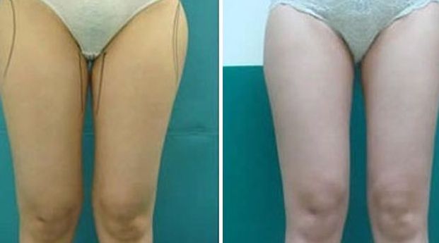 揭陽激光美容醫(yī)院哪家好？選擇揭陽最佳激光美容醫(yī)院的7個關鍵要素！
