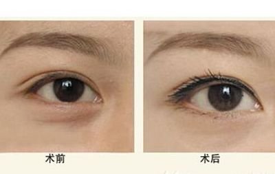 寧波隆鼻Top5醫(yī)生：技術(shù)精湛，聲譽(yù)卓越，口碑贊不絕口！