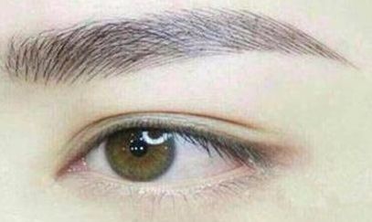 張路九院雙眼皮割好評(píng)如何？