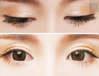西寧豐胸整形醫(yī)院排名前三，專業(yè)醫(yī)生推薦！